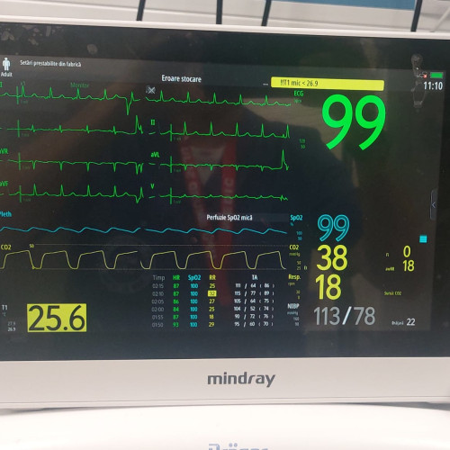 Unitatea de Primiri Urgente a Spitalului Judetean Sibiu, dotata cu un aparat ultraperformant