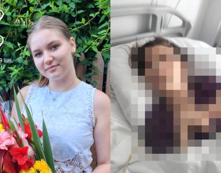Andreea, tânăra care luptă după două stopuri cardio-respiratorii, are nevoie de ajutor